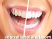 Whitening Teeth Gel