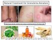 Greneton, Granuloma Annulare Natural Treatment