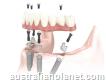 Highly Experienced Dentists Team Providing Best Dental Implant Treatment in Ballarat