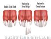 Fill the Gap between Your Teeth with Affordable Dental Bridges Treatment