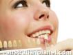 Teeth Whitening From The Best Dental Care Institution