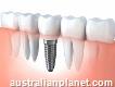Best class bone grafting procedure – Dental Implants – Perth