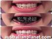 Great super natural whitening teeth swarbs call +27603591149