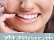 $99 Take - Home Whitening Special