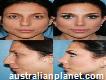 Best Nose Plastic Surgery Hyderabad