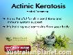 Herbal Treatment for Actinic Keratosis