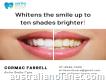 Whitens the smile up to ten shades brighter