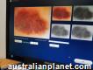 Practice profile Skin Cancer Melbourne Rosebud Superclinic