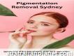 Get the Best Pigmentation Removal Treatment and Improve Your Skin